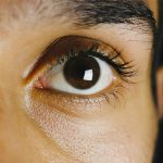 imagen del artículo: Pérdida de visión del ojo derecho tras una intervención de cataratas